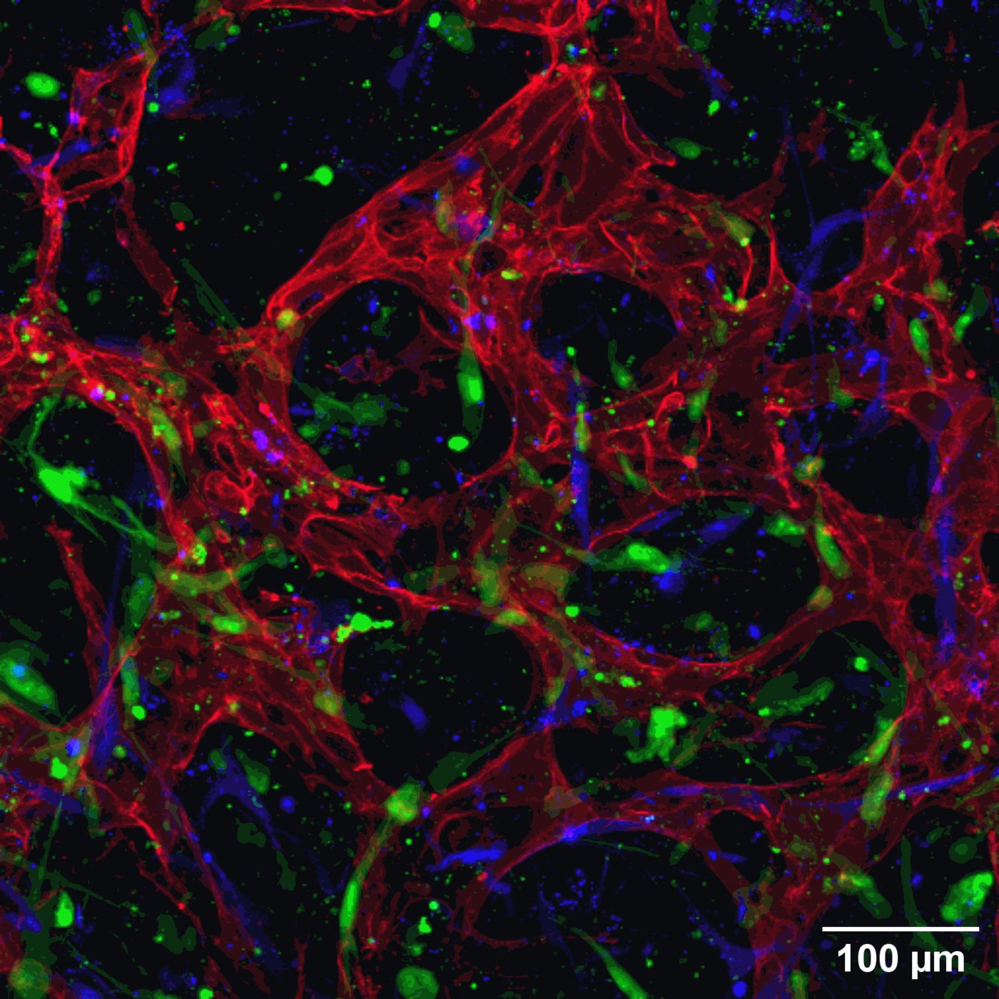  Agathe Figarol - Cerebral microvessels developped in vitro. Red : human brain endothelial cells, green : astrocytes, blue : pericytes.