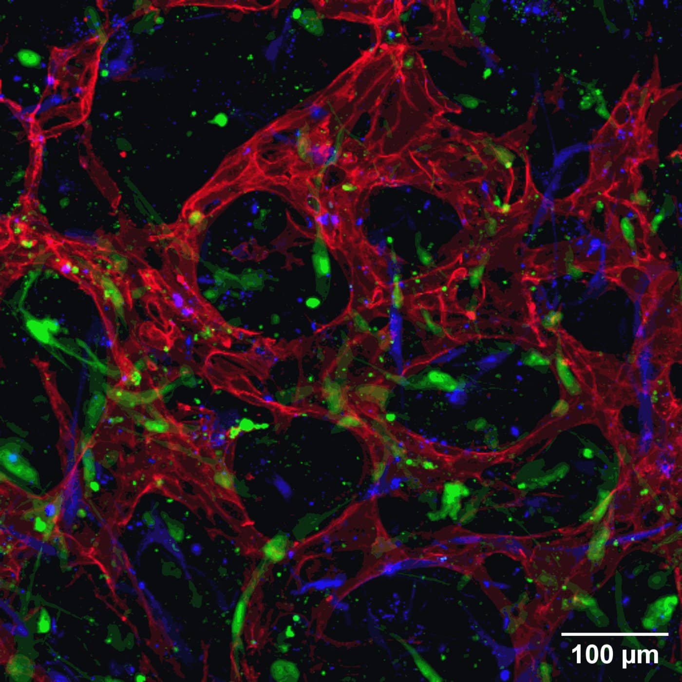  Agathe Figarol - Cerebral microvessels developped in vitro. Red : human brain endothelial cells, green : astrocytes, blue : pericytes.