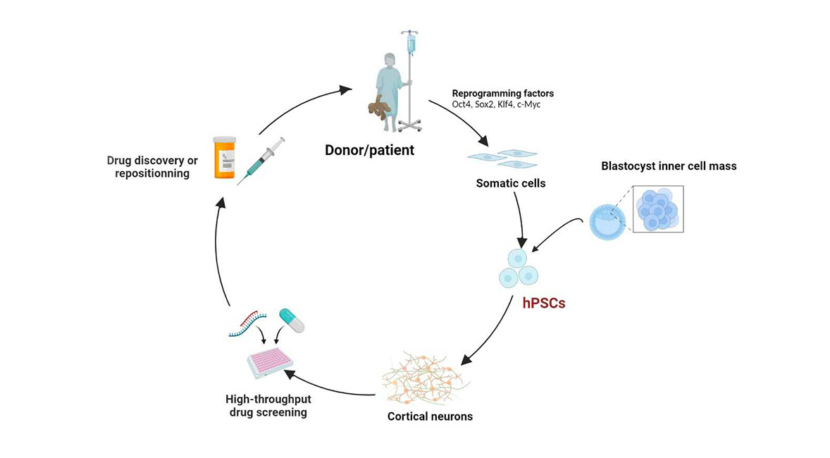  A Benchoua - Method cycle using iPSCs: from source to processing