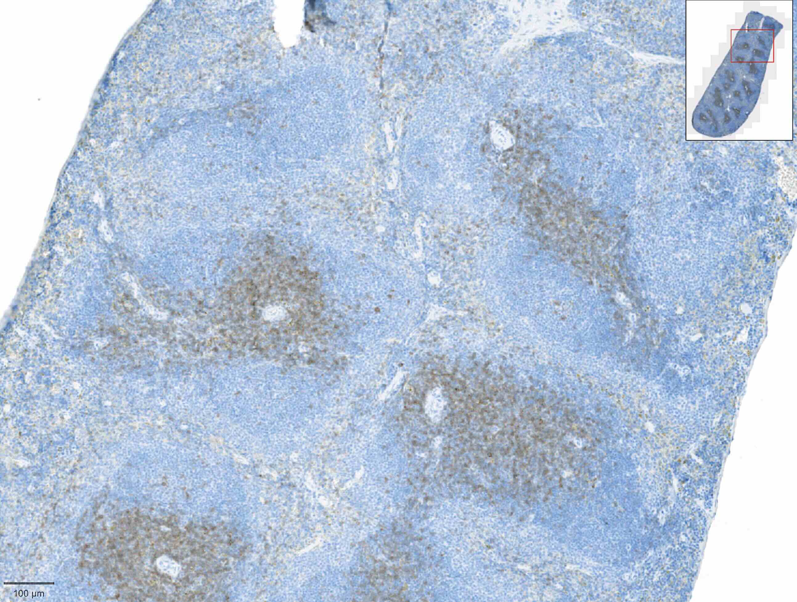 Lgende : marquage avec anti-CD3 CST #85061 (Recombinant monoclonal) sur coupe de rate de souris  APEX